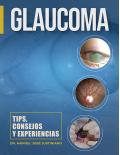 Glaucoma: tips, consejos y experiencias